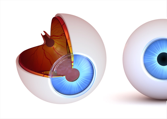 Glaucoma