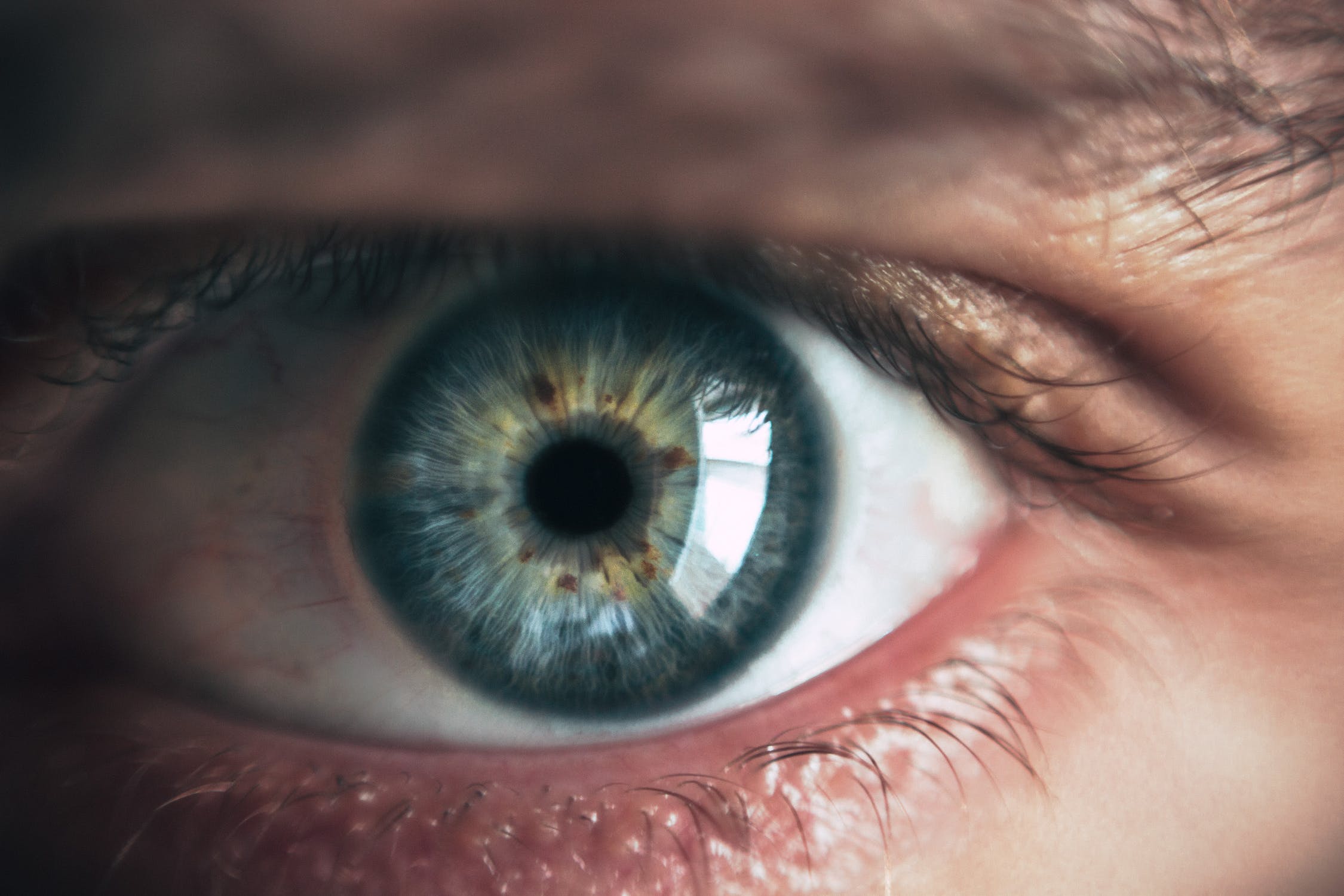 How To Spot Cataracts Early Beyond Vision 