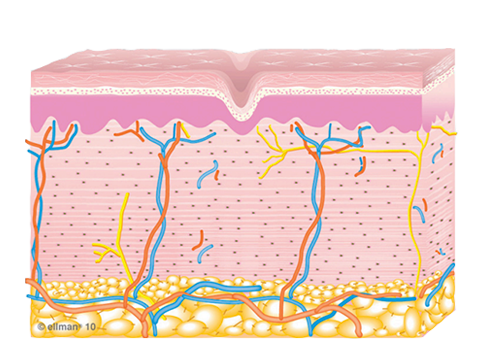Collagen Remodeling Occurs illustration